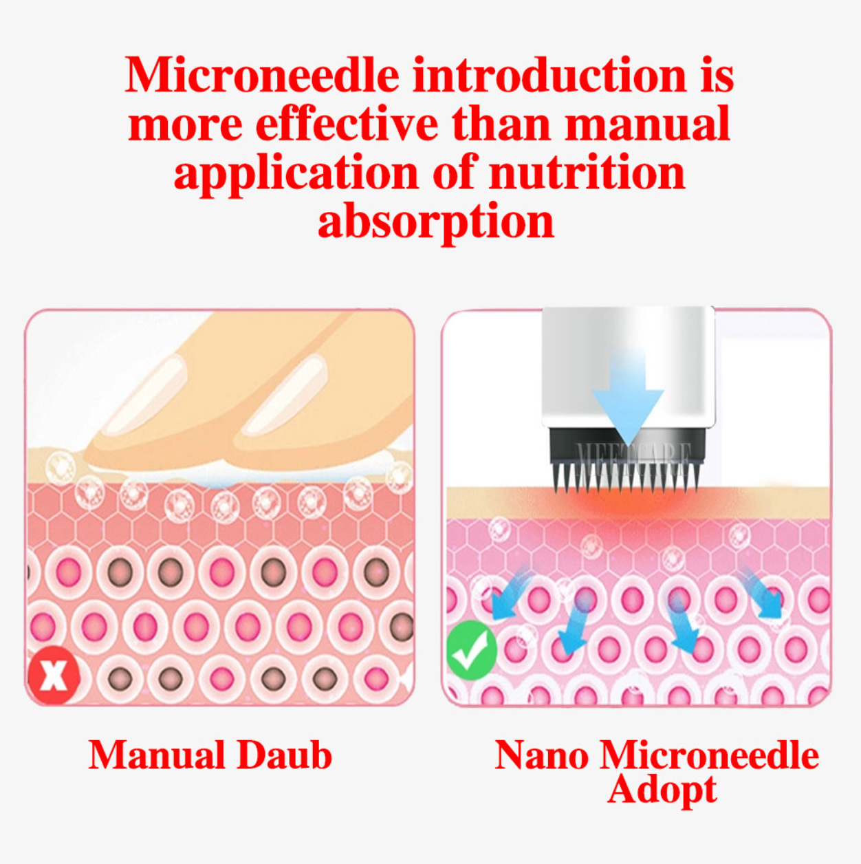 Coffret Stylo Microneedling