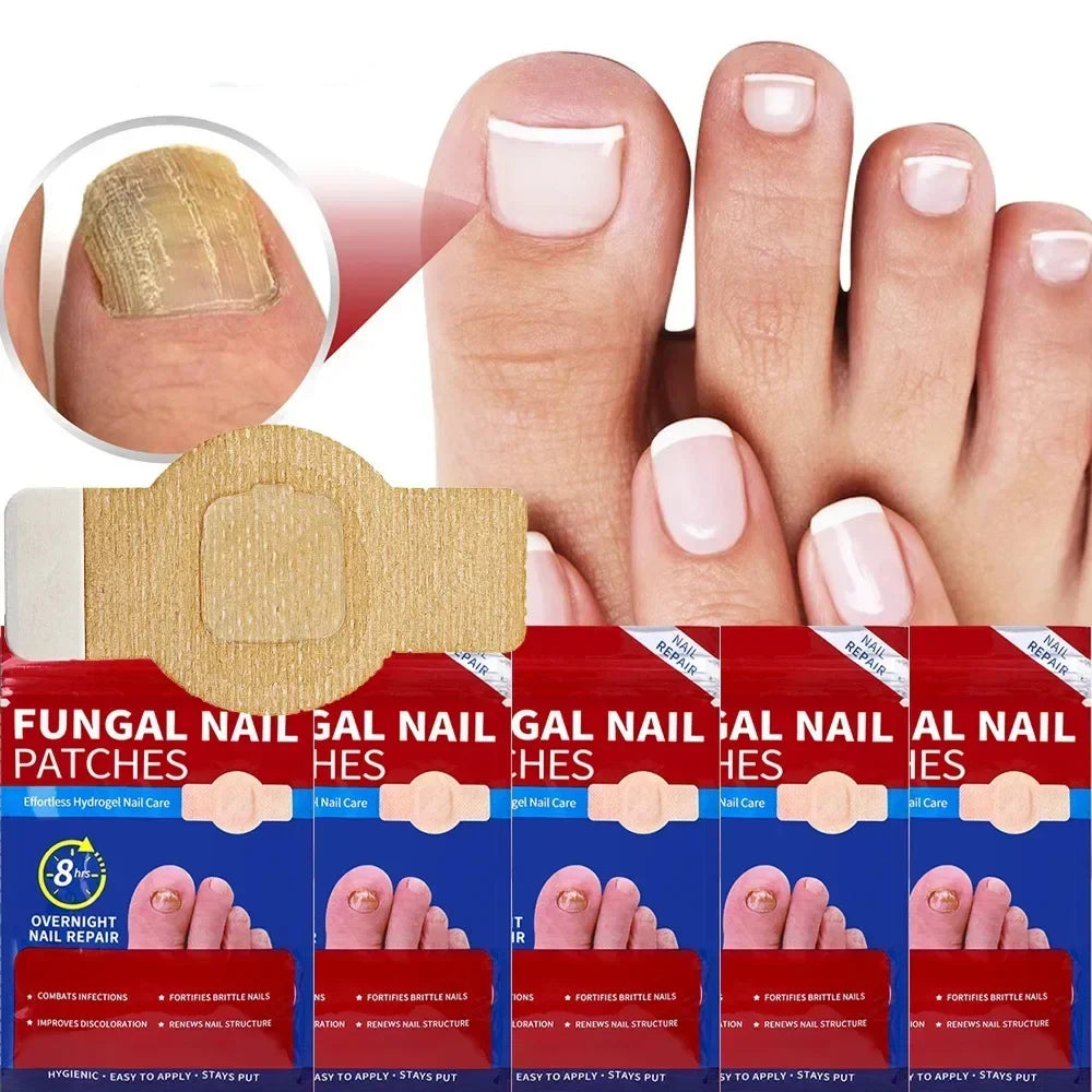 Lot de 42 Patchs Anti-Mycose, Champignons & Incarnation pour Ongles